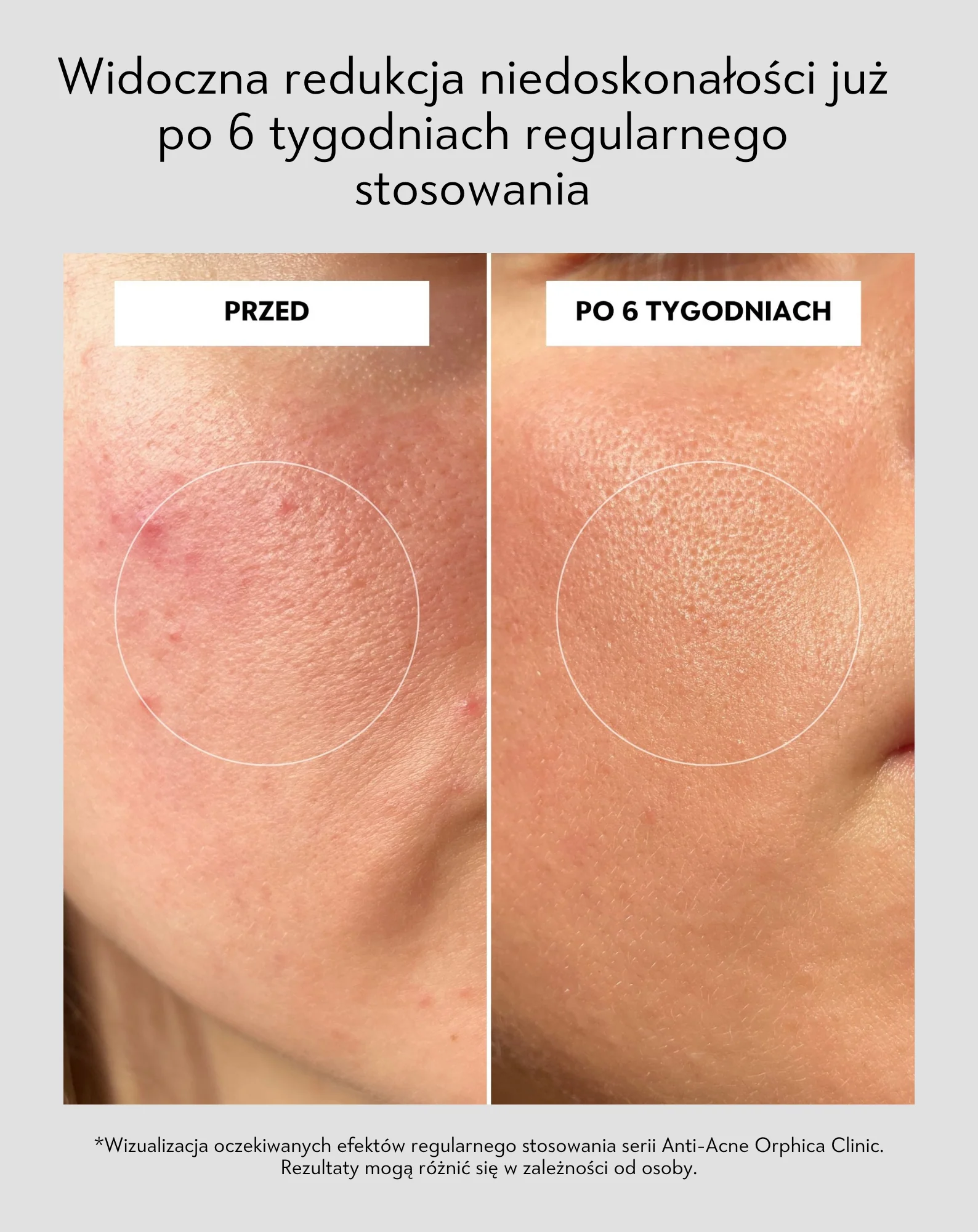 Zdjęcie produktu 5