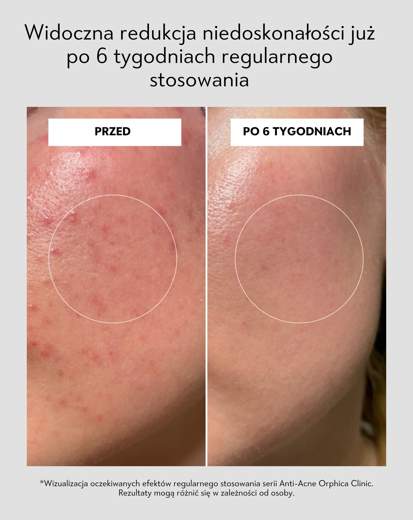 Zdjęcie produktu 6